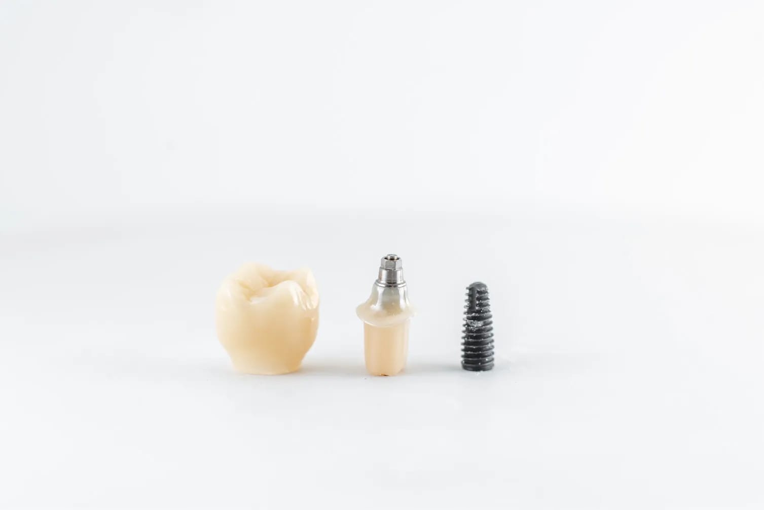 Single Tooth Implant Cost in Dubai – Key Factors to Consider