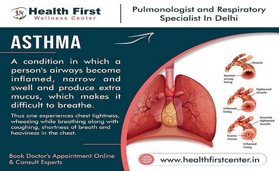 Asthma Specialist: Dr. Sanchayan Roy – Your Path to Easy Breathing