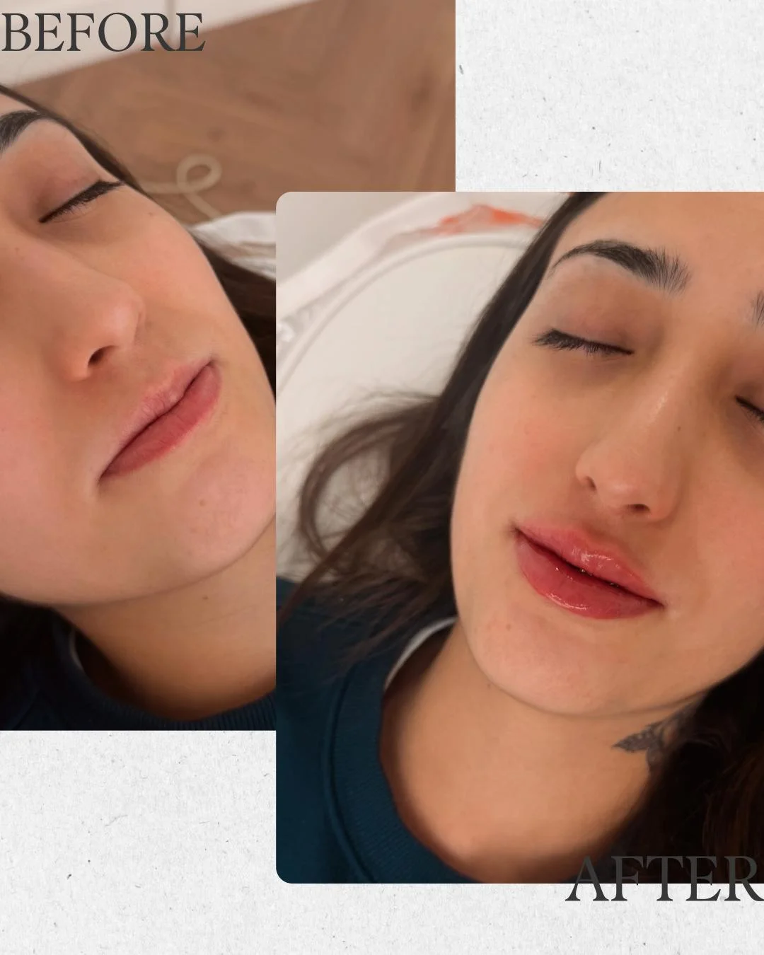 How a Skin Clinic Near Me Can Help You Achieve Long-Term Skin Health