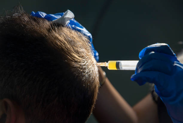 What Happens After the First Session? PRP Hair Treatment in Islamabad: