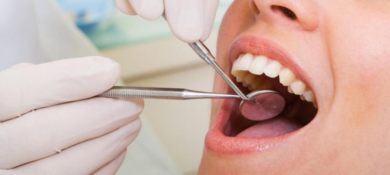 Full Mouth Rehabilitation in Dubai: Common Questions Answered