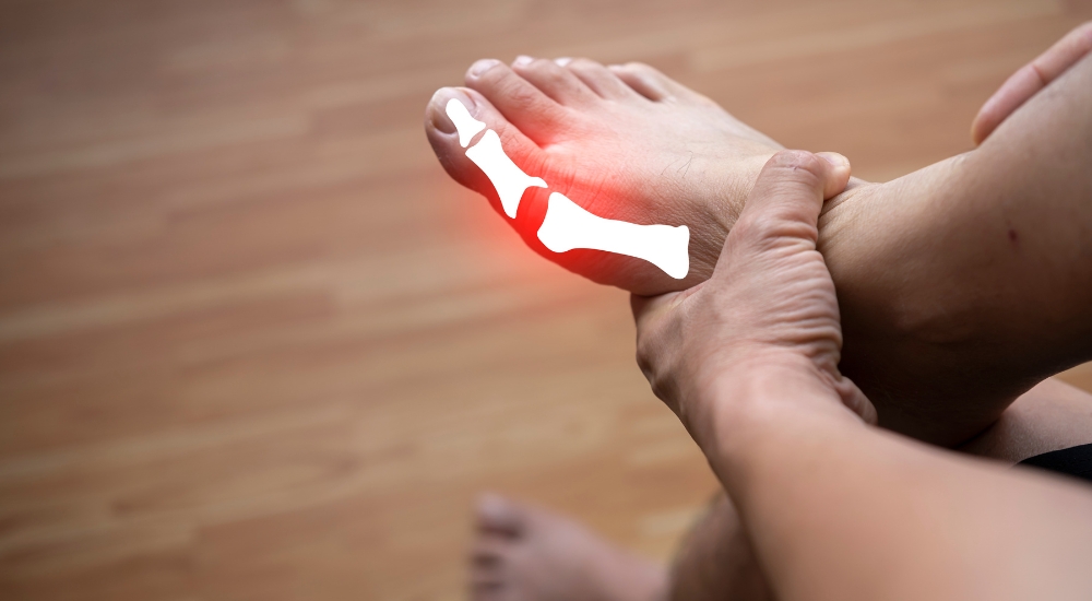 What Are the Top 7 Medications Commonly Used in Gout Treatment