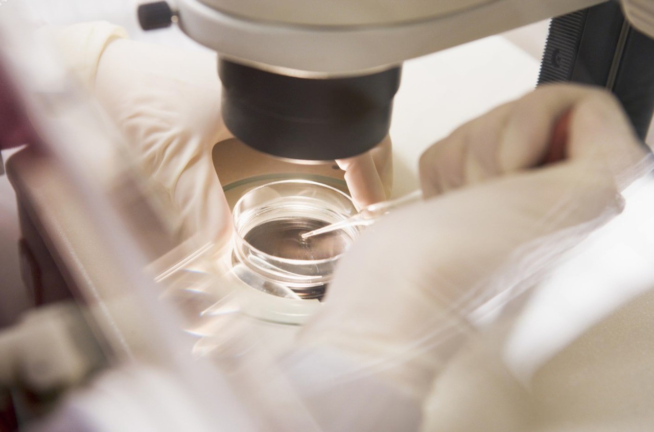 Preparing for Hysteroscopy Services in Lahore, A Patient Guide