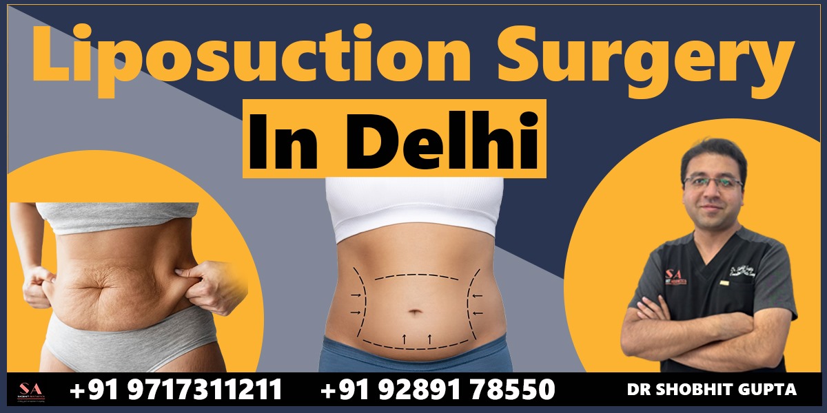 Achieve Your Ideal Body with Liposuction Surgery in Delhi