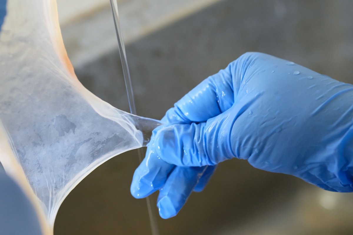 How Amniotic Membrane Grafts Improve Chronic Wound Care Outcomes
