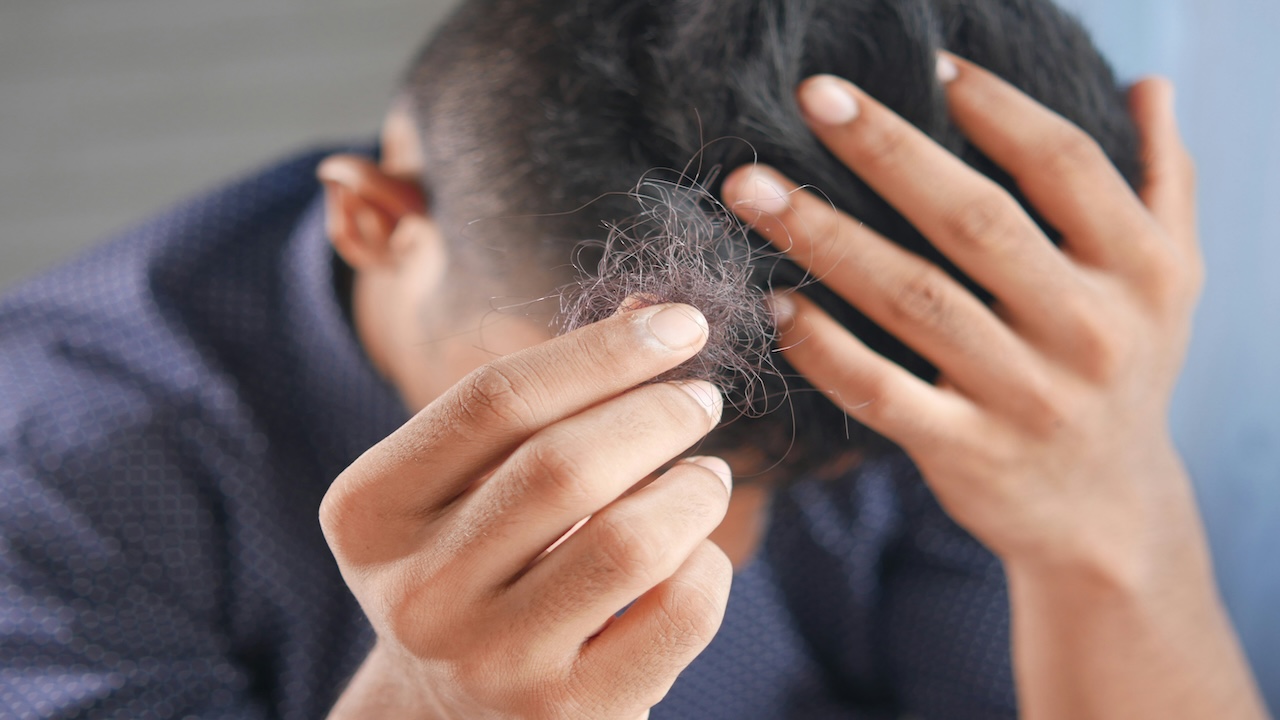 How to Choose a Hair Transplant Clinic in the UK: 10 Questions to Ask