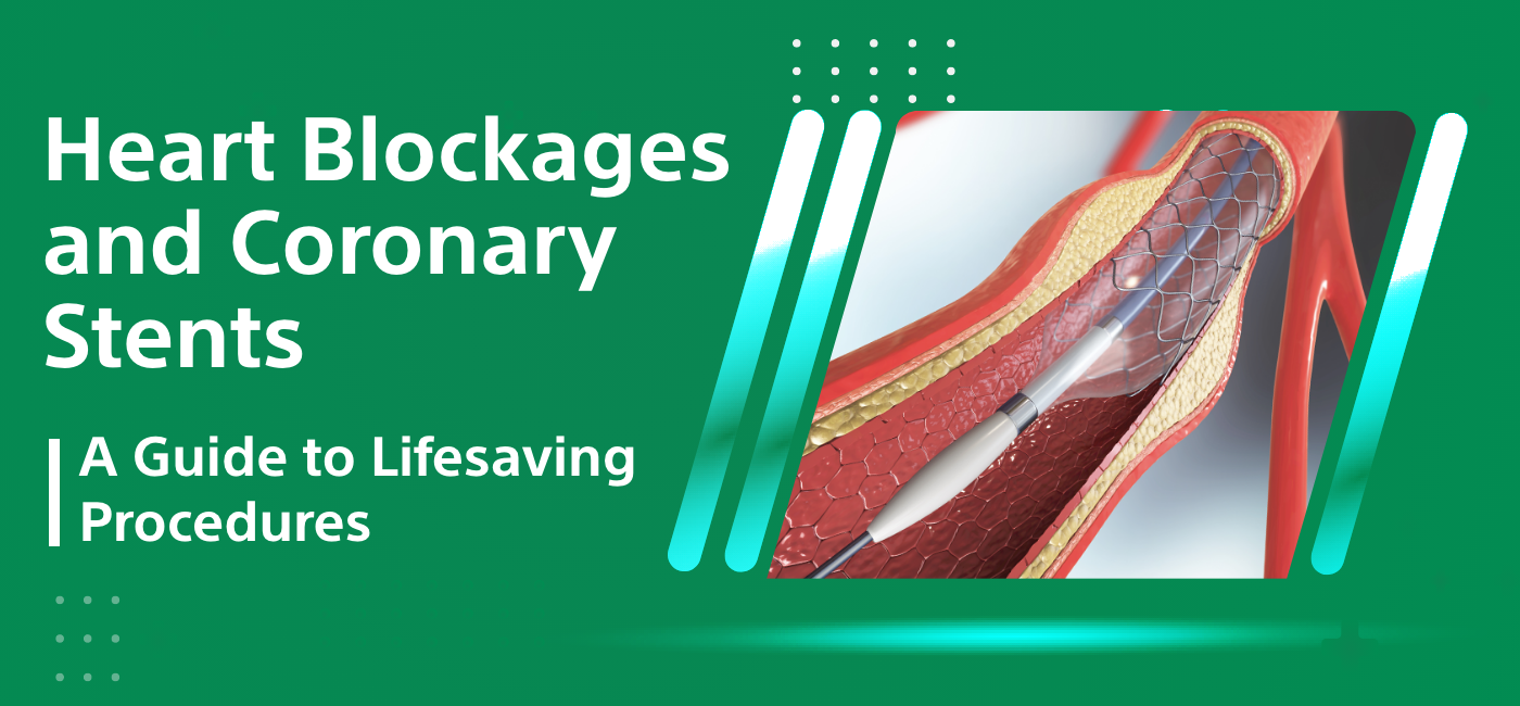 Heart Blockages and Coronary Stents: A Guide to Lifesaving Procedures